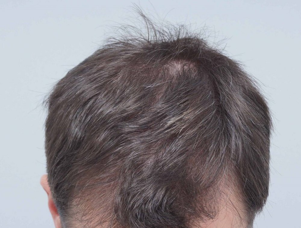 Farjo Hair Institute 2.jpg