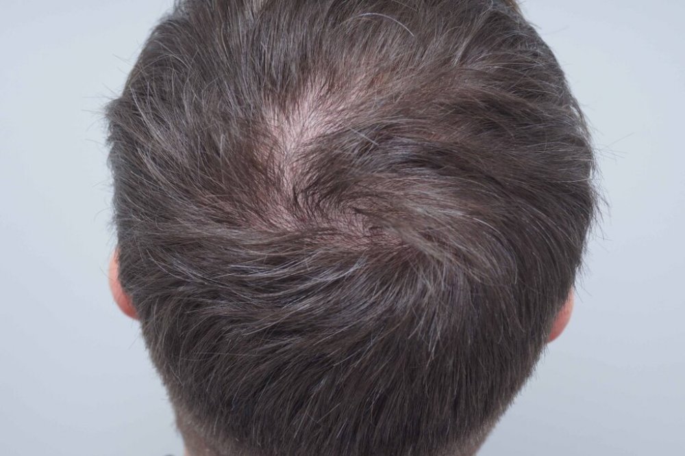 Farjo Hair Institute 5.jpg