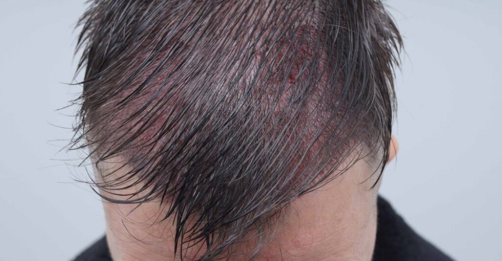 Farjo Hair Institute 6.jpg
