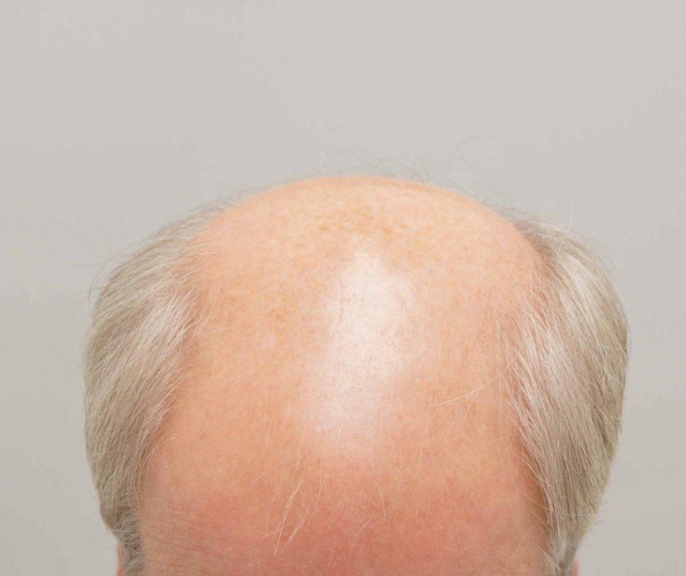 Farjo Hair Institute1.jpg