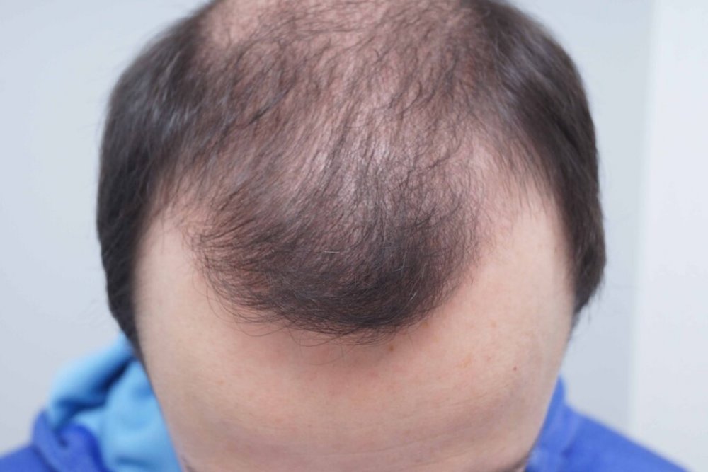 Farjo Hair Institute1.jpg
