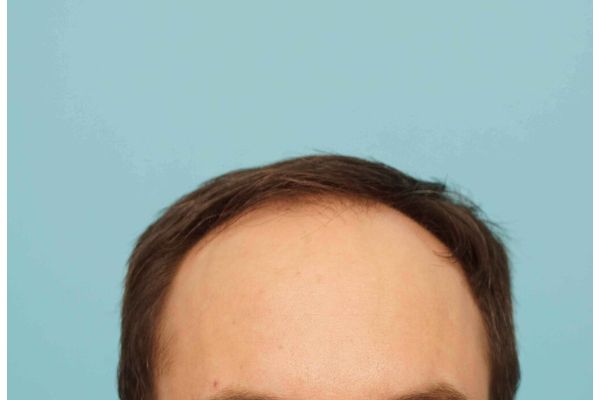 Farjo hair institute1.jpg