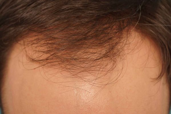 Farjo hair institute2.jpg