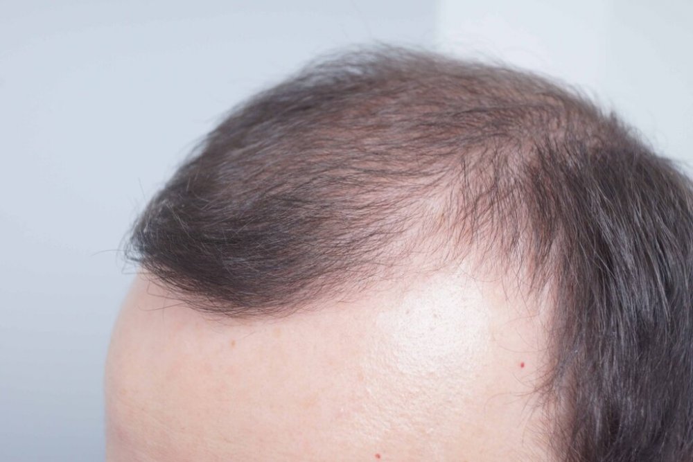 Farjo Hair Institute3.jpg