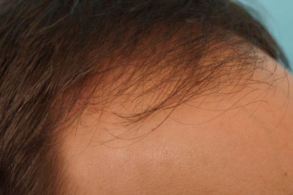 Farjo hair institute3.jpg