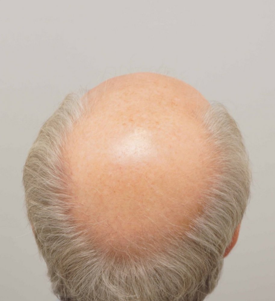 Farjo Hair Institute4.jpg
