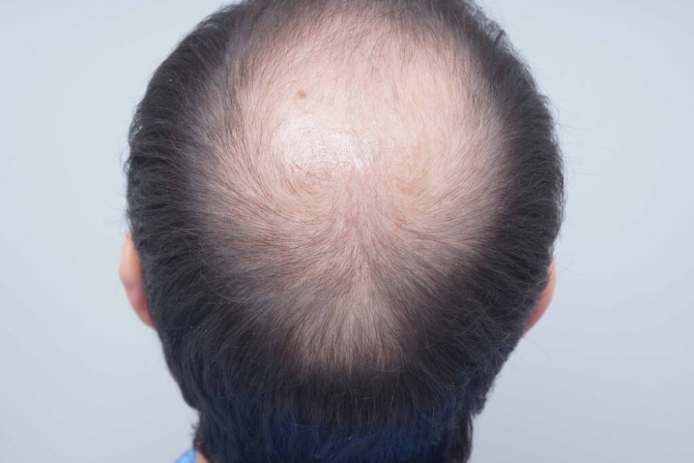 Farjo Hair Institute4.jpg
