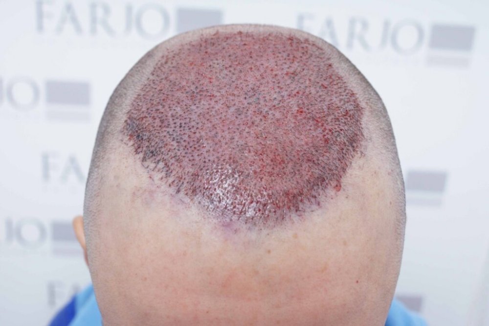 Farjo Hair Institute5.jpg