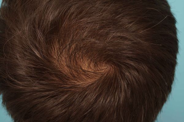 Farjo hair institute5.jpg