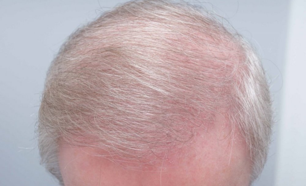 Farjo Hair Institute6.jpg