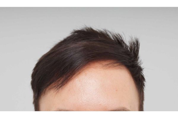 Farjo hair institute6.jpg