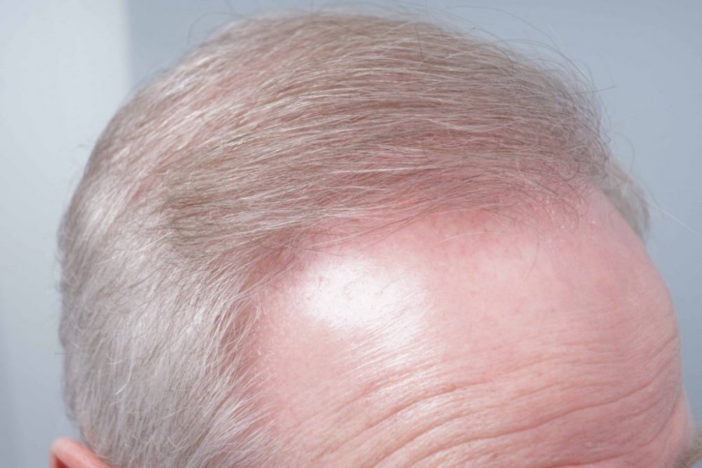 Farjo Hair Institute7.jpg