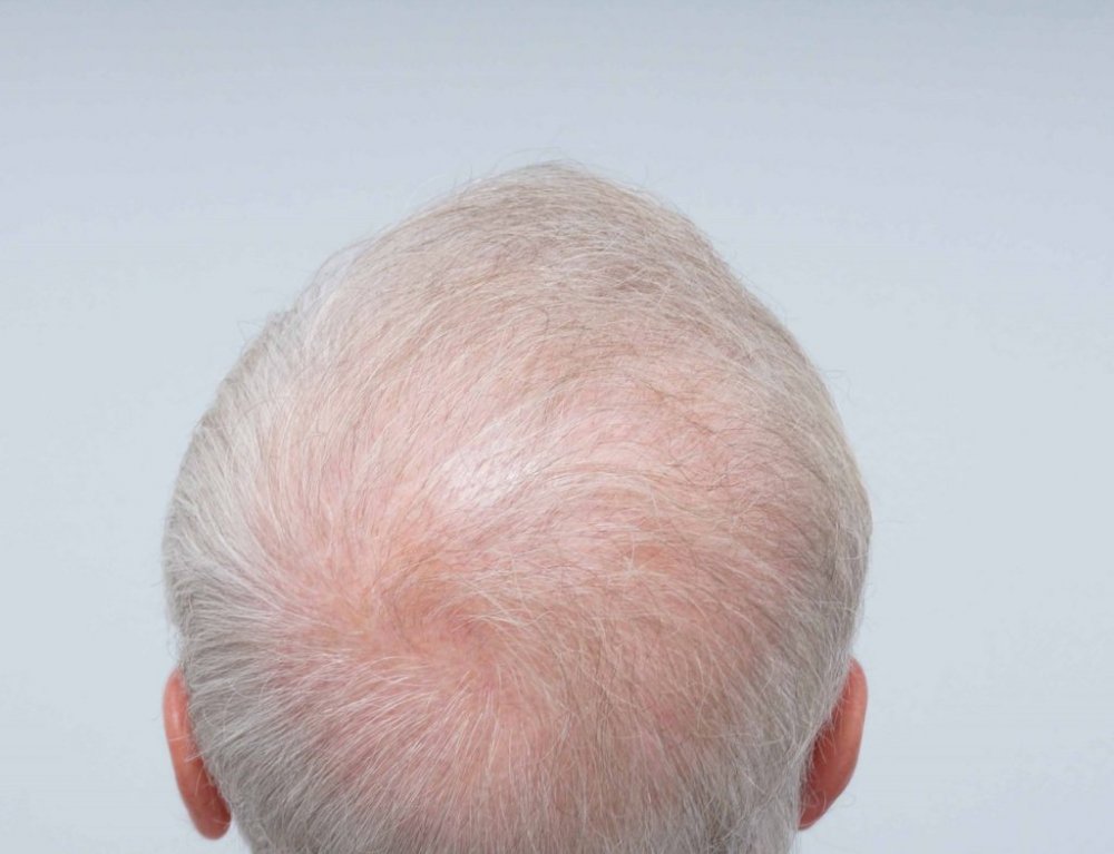Farjo Hair Institute9.jpg
