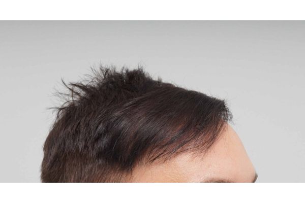 Farjo hair institute9.jpg