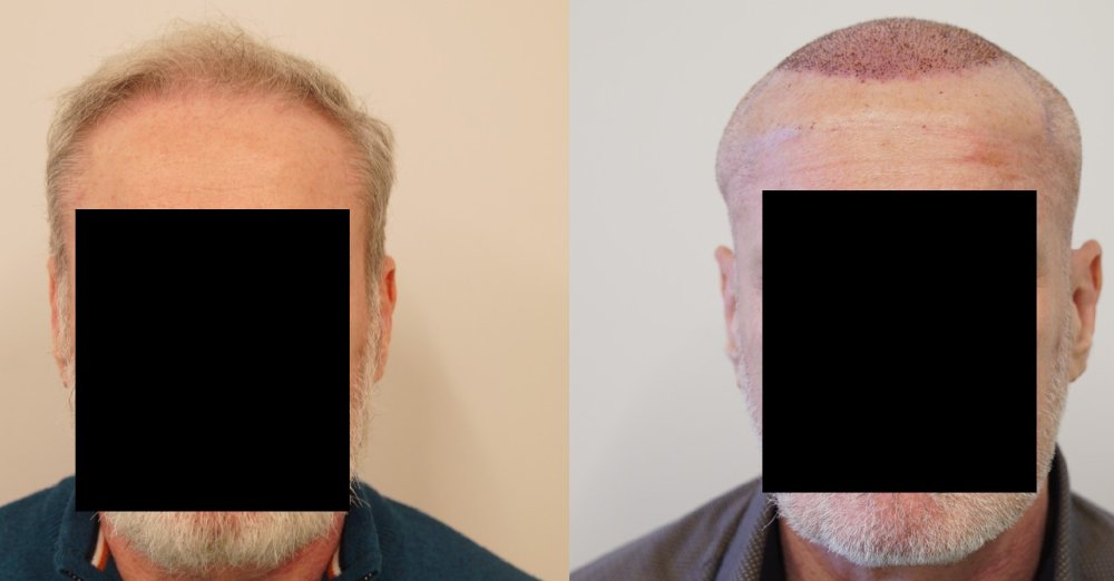 Front day 1.jpg