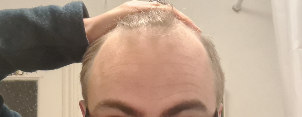 front held back.png
