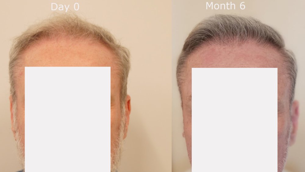 front month 0 v month 6.jpg