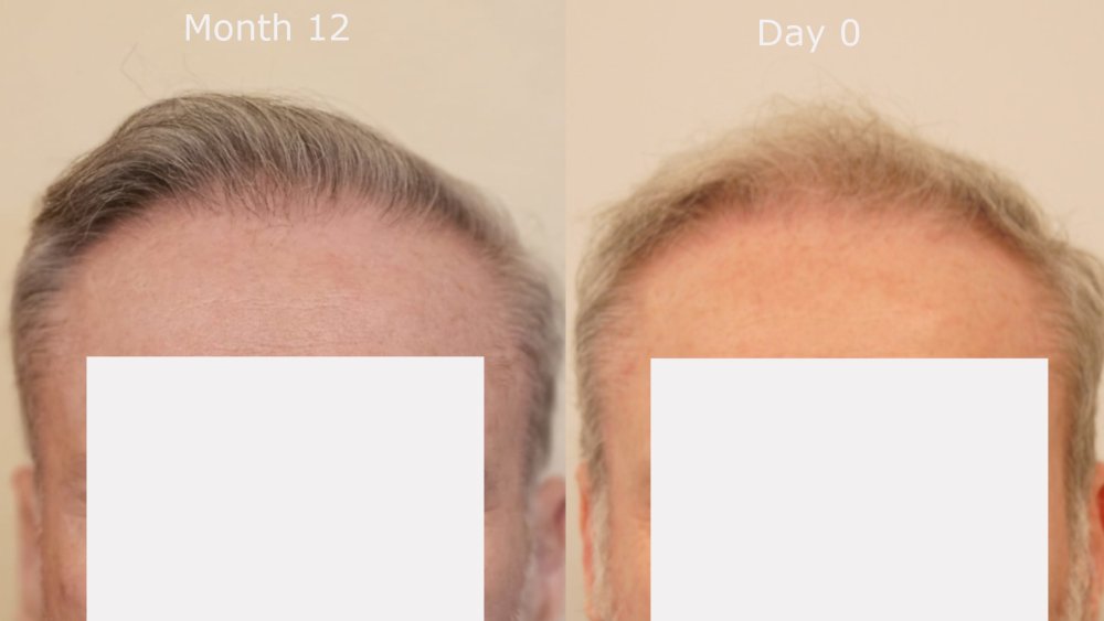 front month 12 v Day  0.jpg
