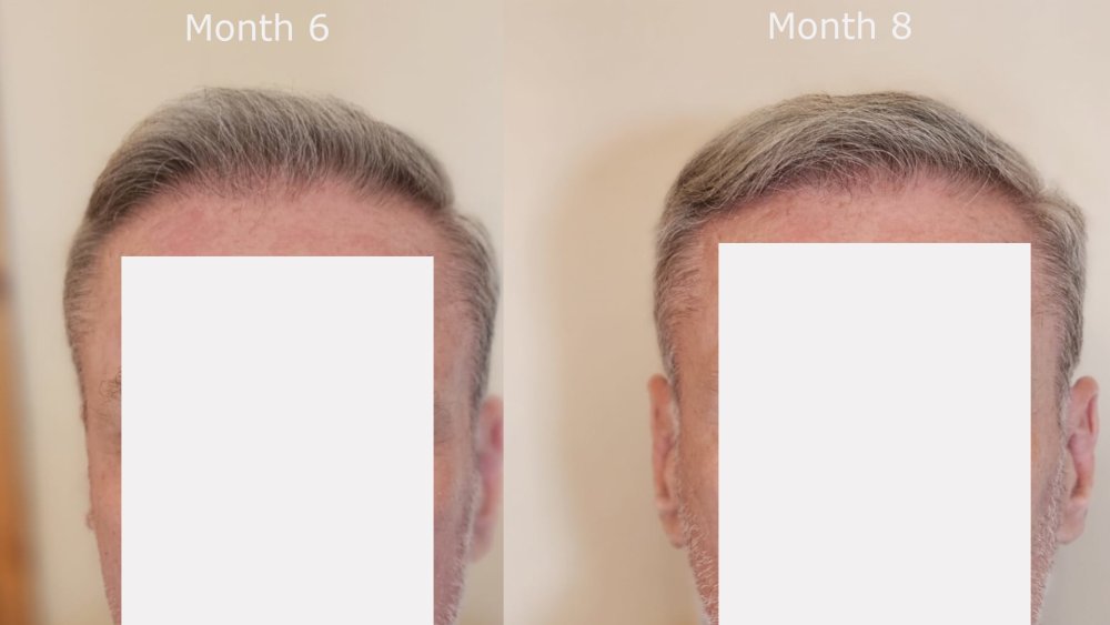 front month 6 v month 8.jpg