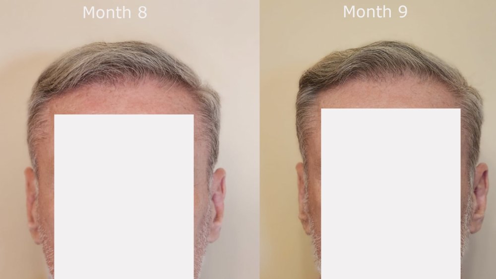 front month 8 v month 9.jpg