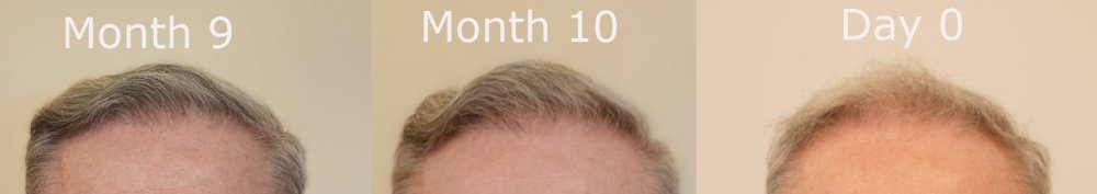 front month 9 v month 10 v day 0.jpg
