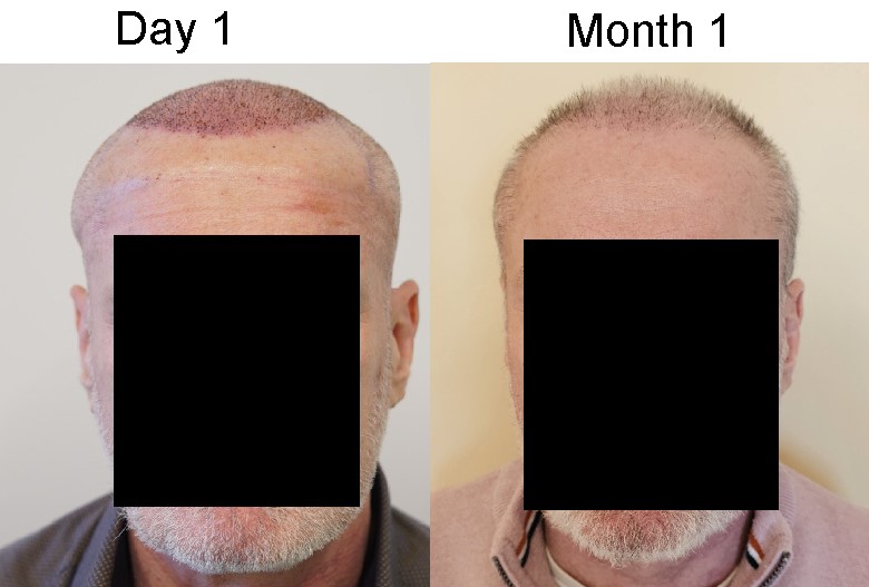 front month1.jpg