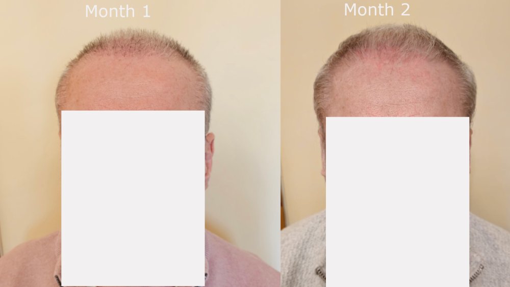 front month1 v month2.jpg