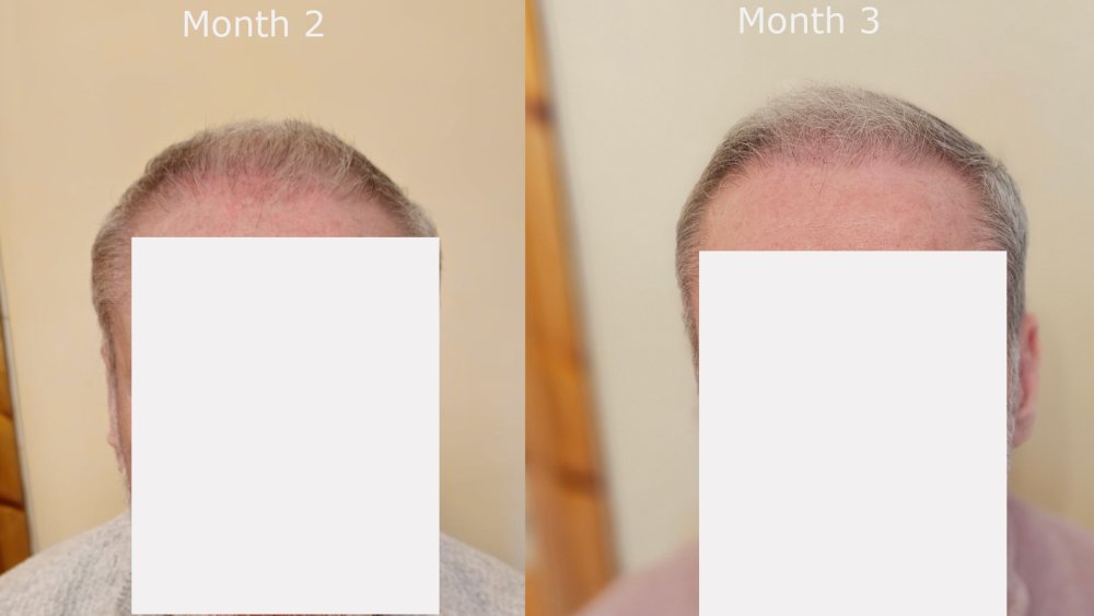 front month2 v month3.jpg