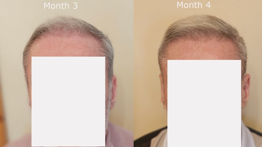 front month3 v month4.jpg