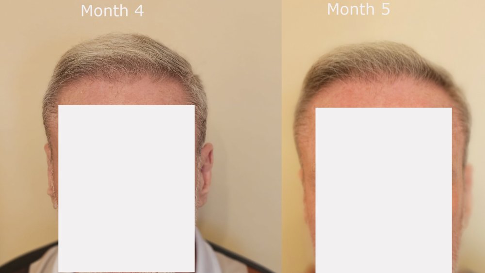 front month4 v month5.jpg