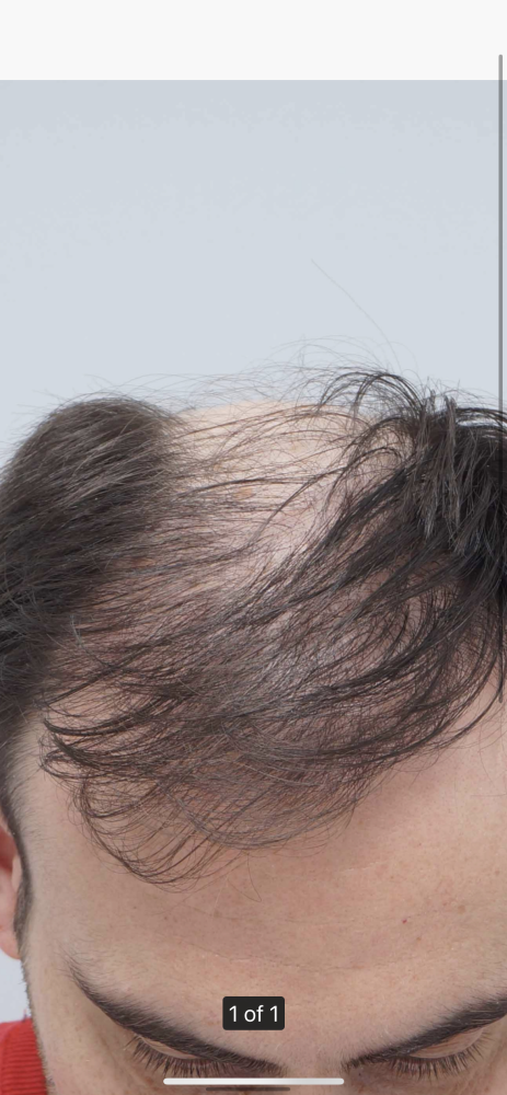 Front top .png