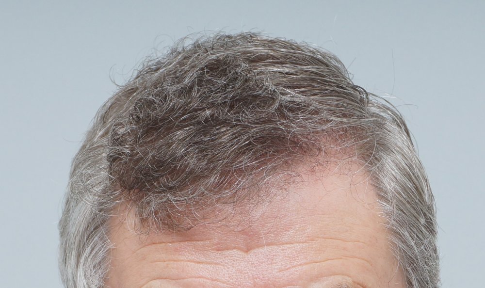 FUE Farjo Hair Institute1.JPG