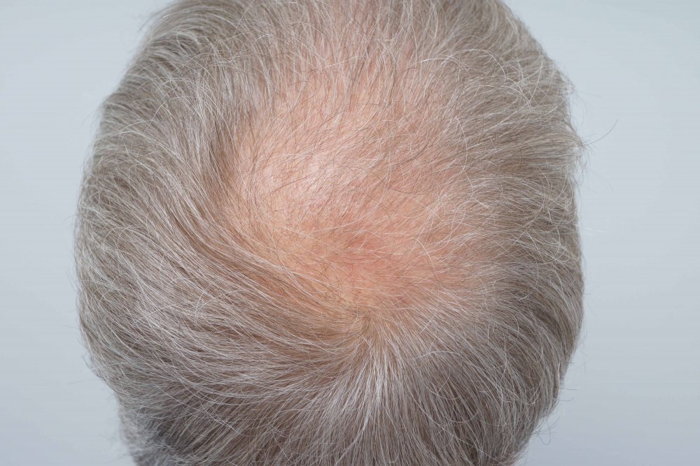 FUE Farjo Hair Institute11.jpg