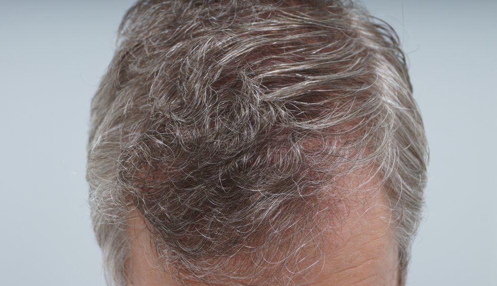 FUE Farjo Hair Institute2.JPG