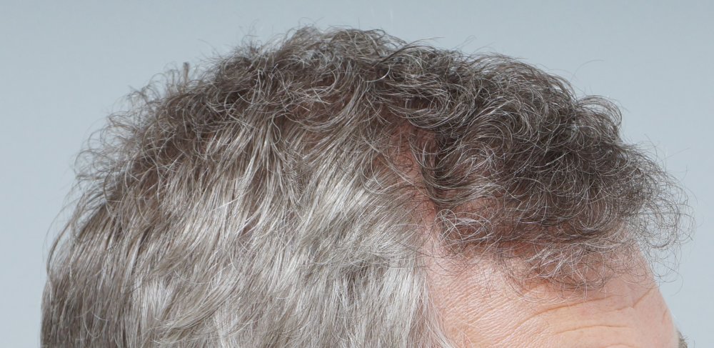 FUE Farjo Hair Institute3.JPG