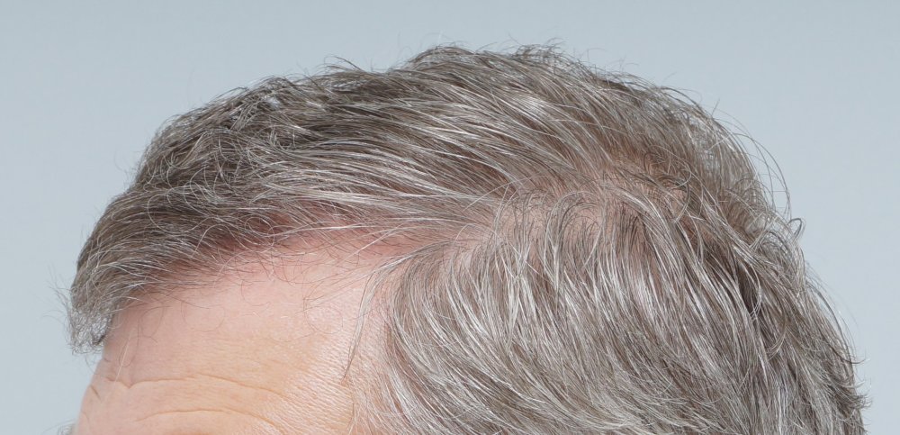 FUE Farjo Hair Institute4.JPG