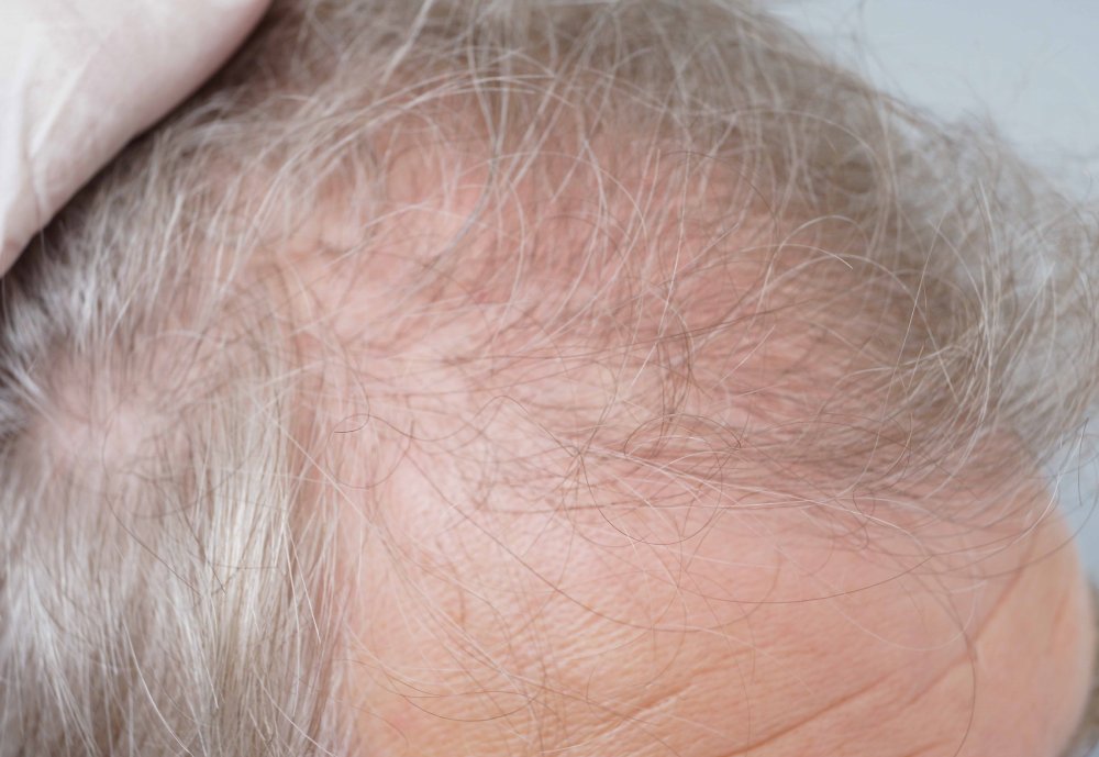 FUE Farjo Hair Institute9.jpg