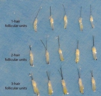 Grafts-1024x956.jpg