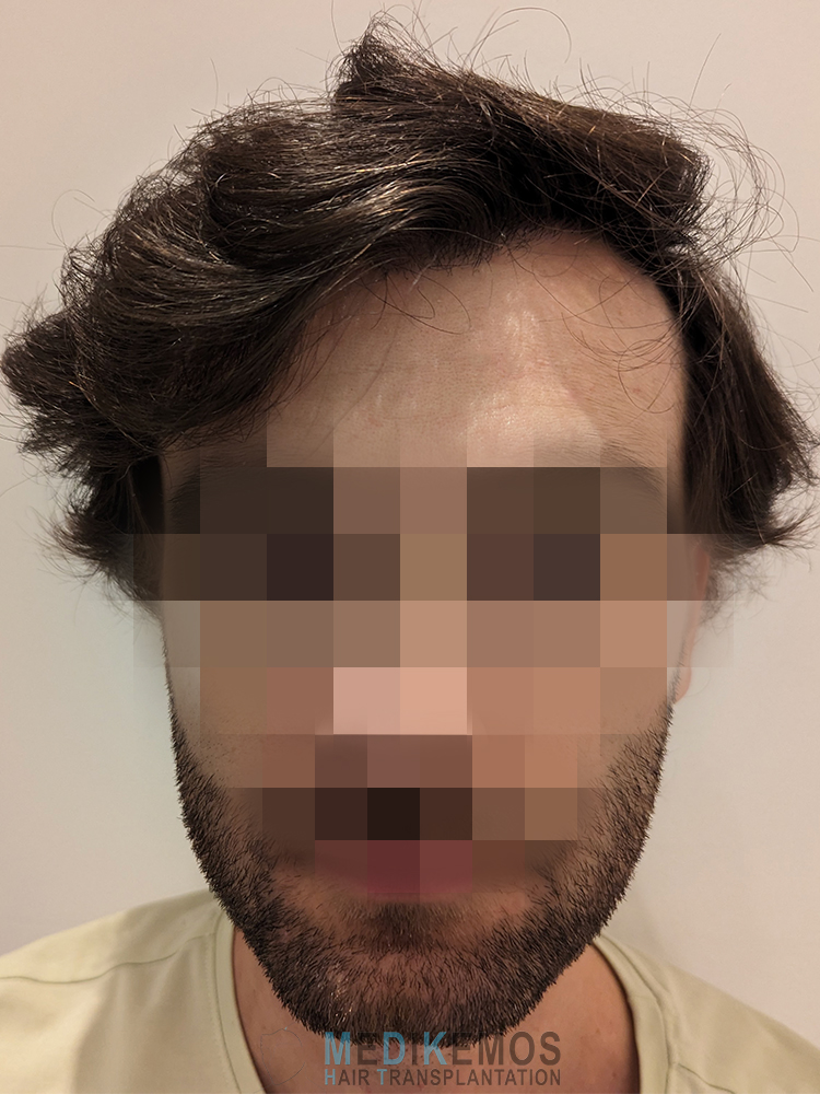 GV_12MONTHS-1.jpg