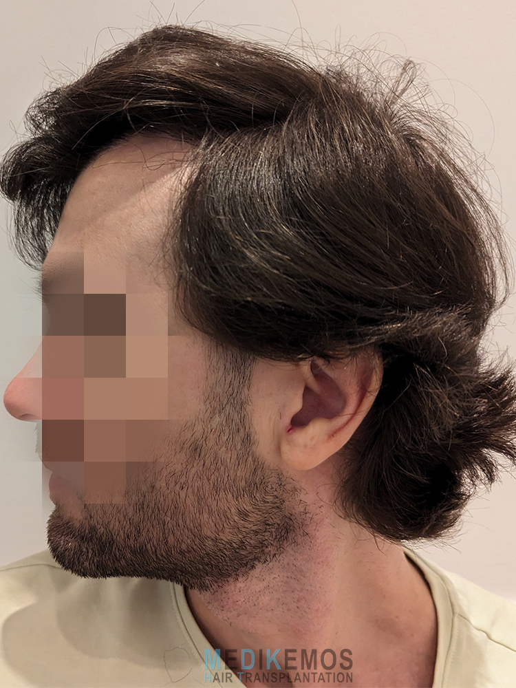 GV_12MONTHS-2.jpg