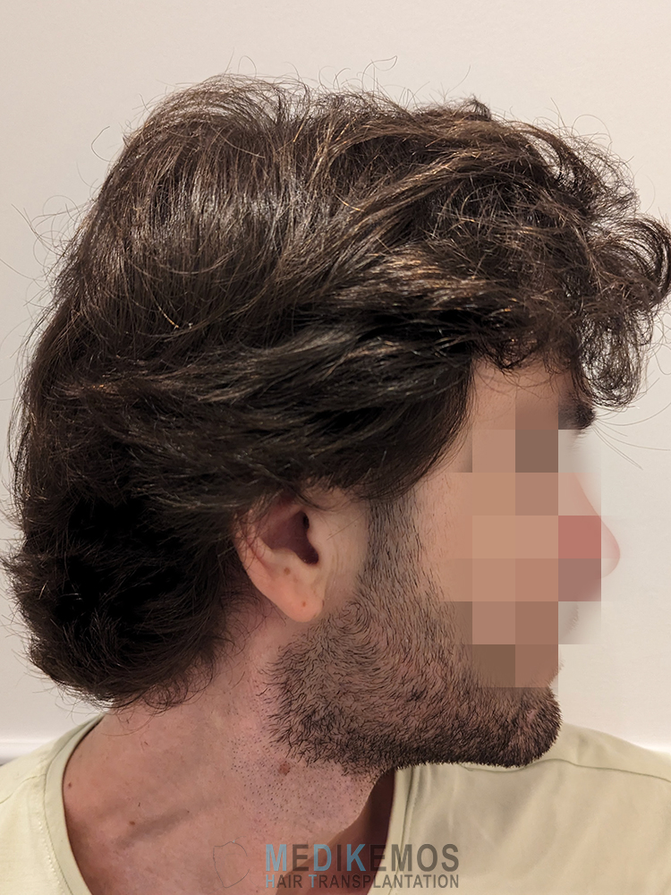 GV_12MONTHS-3.jpg