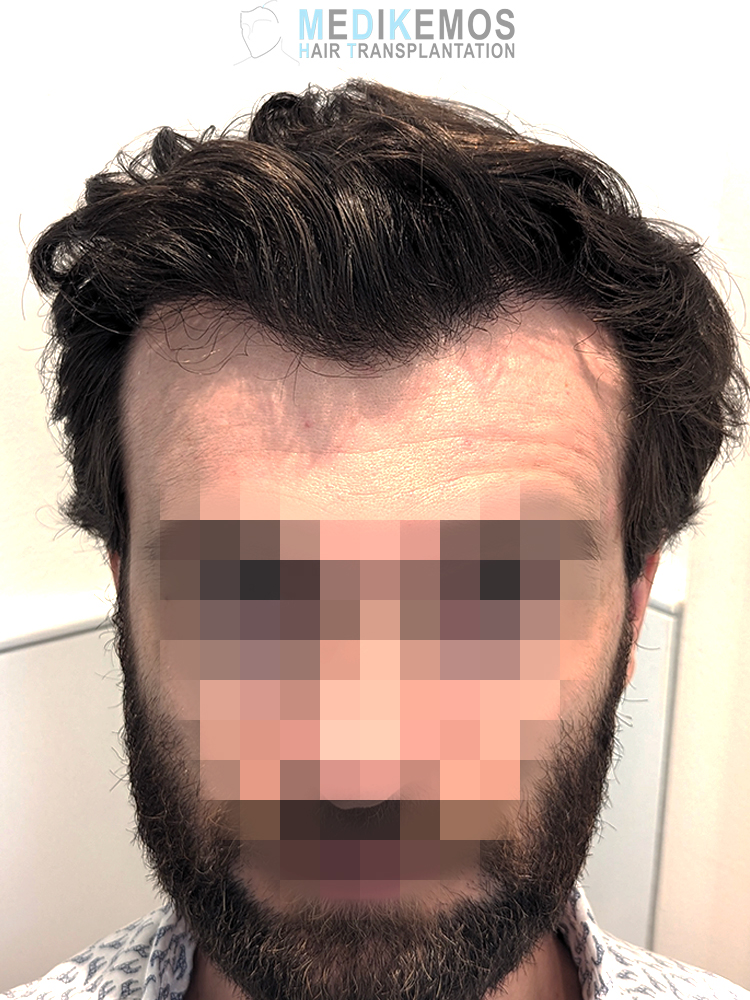 GV_9MONTHS-1.jpg