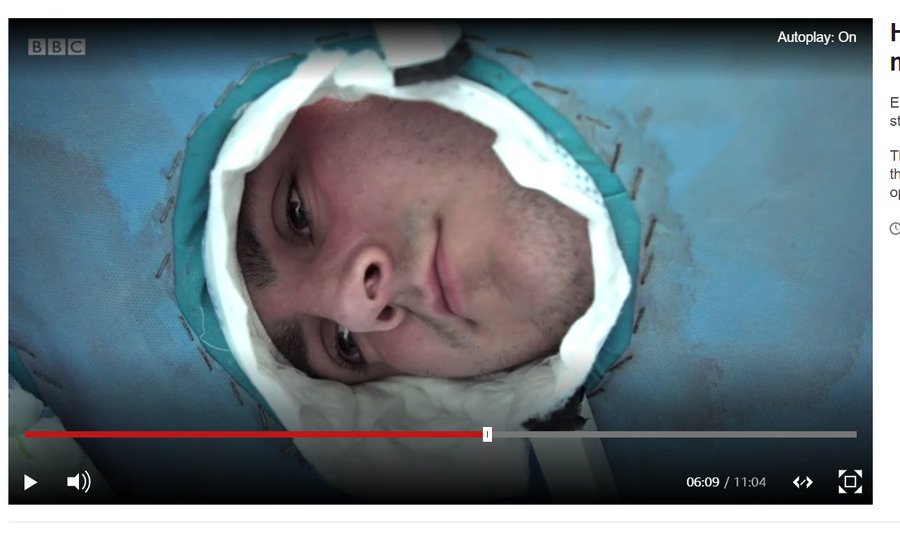 Hair transplant unsafe conditions.jpg