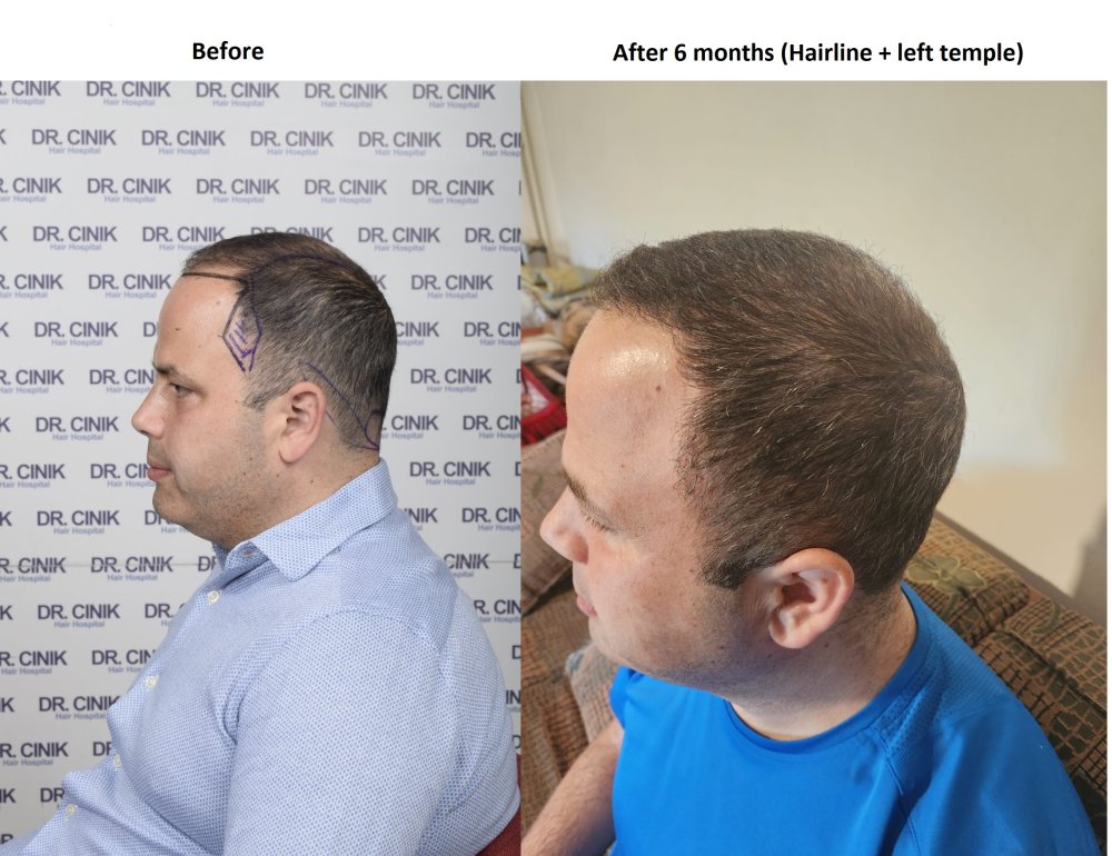 hair_6months_pic1.jpg