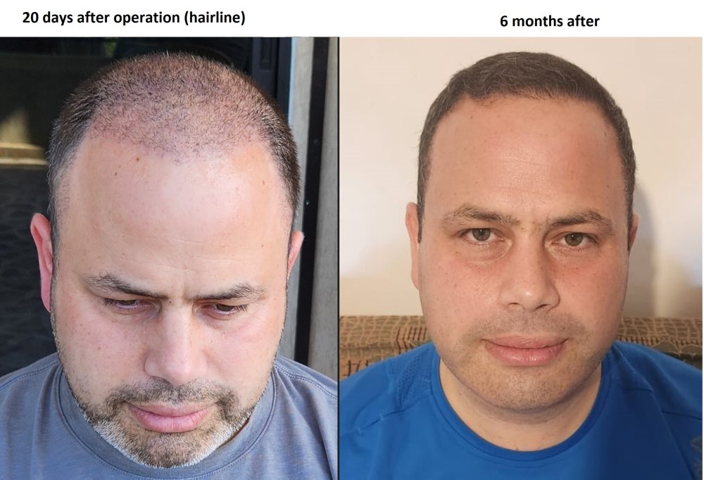 hair_6months_pic4.jpg