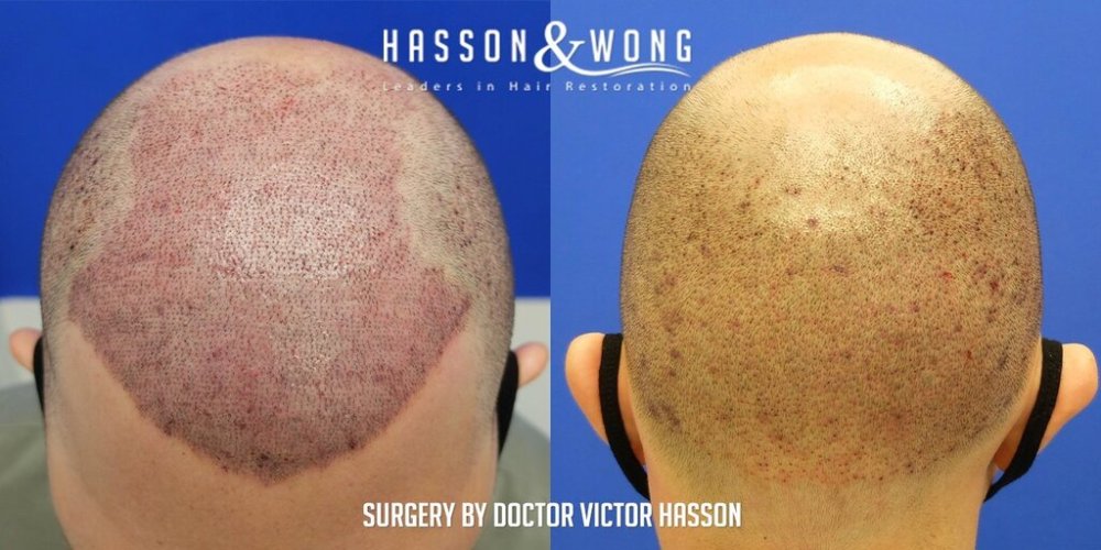 Hasson & Wong 14.jpg