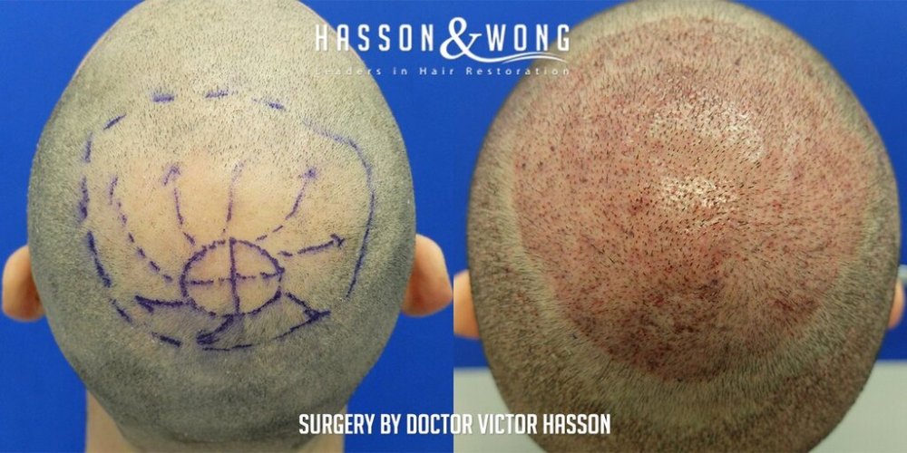 Hasson & Wong 15.jpg