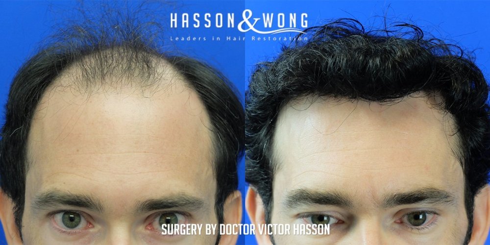 Hasson & Wong 2.jpg