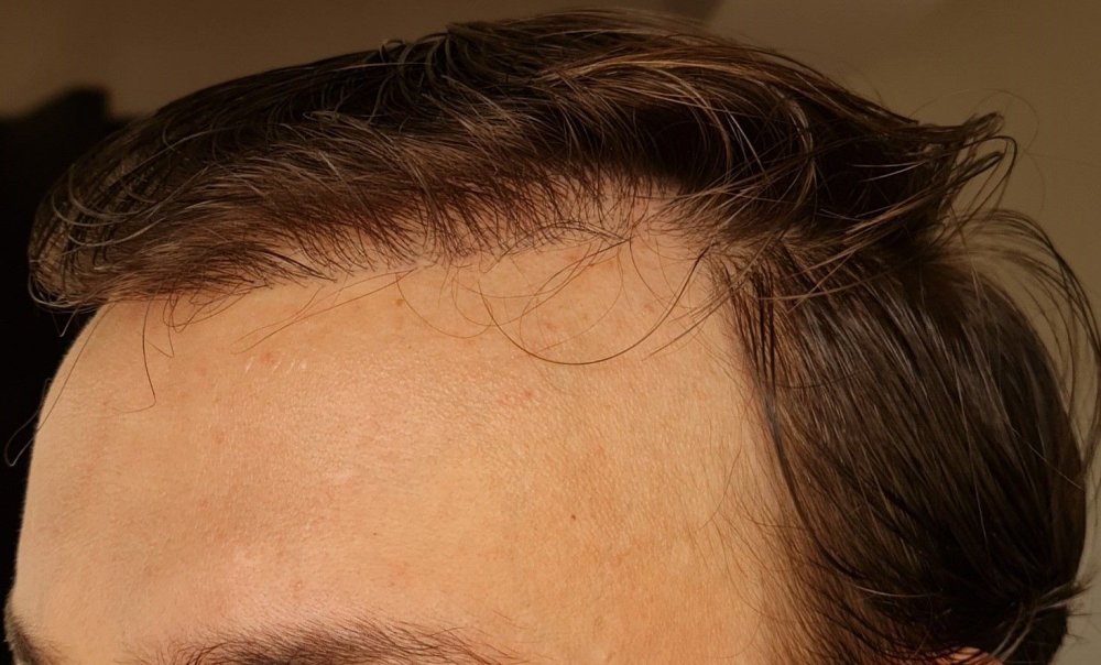 Hattingen Hair1.jpg