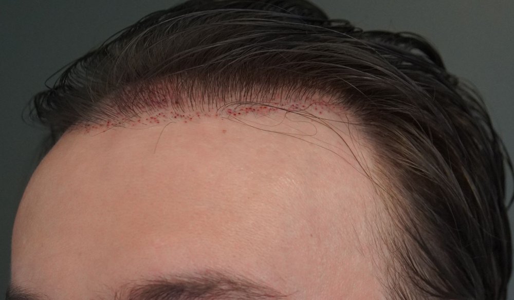 Hattingen Hair2.jpg